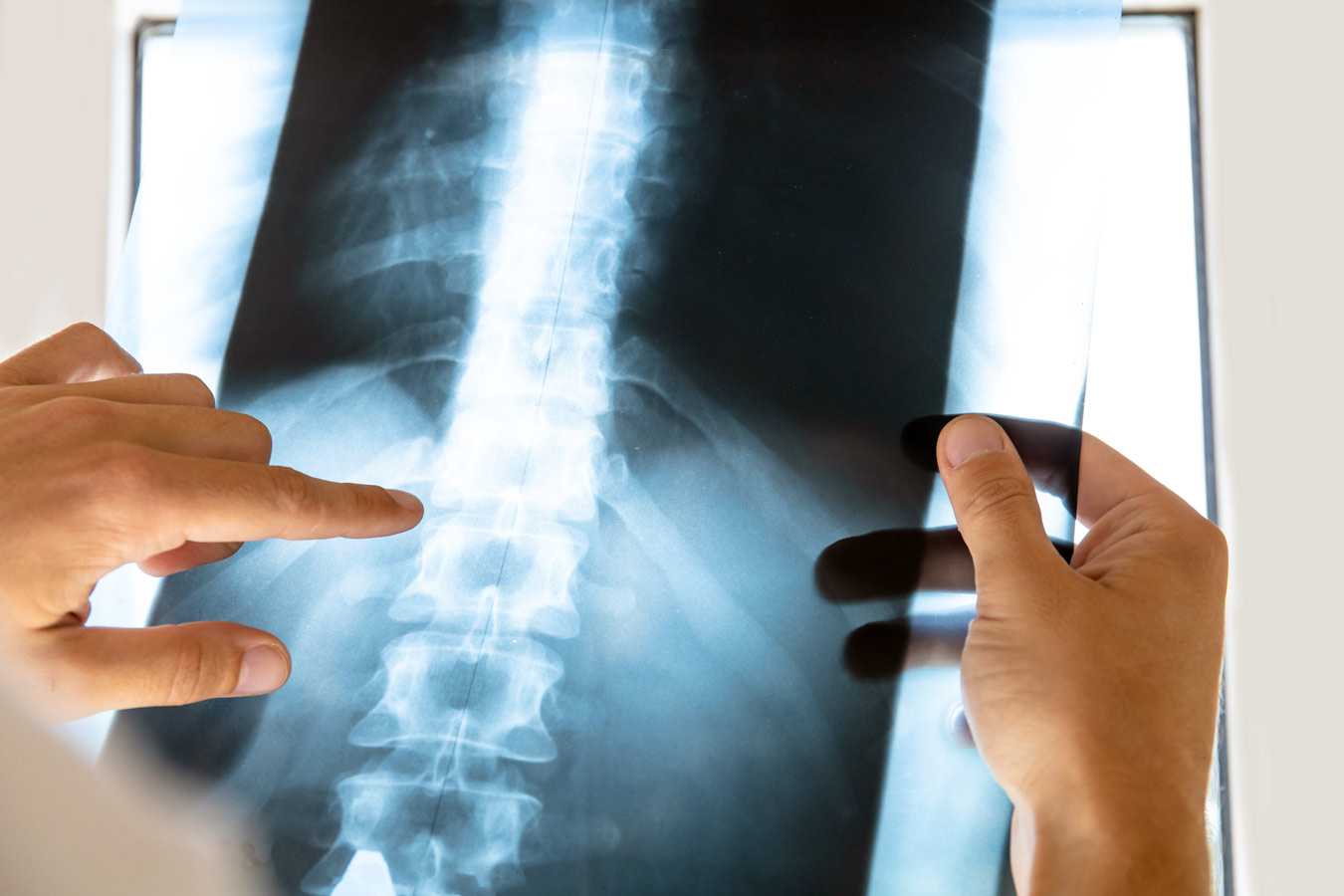 Spinal Misalignment Chiropractic Care